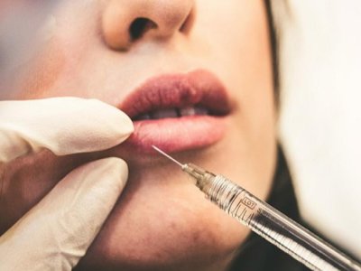 Azərbaycanda qadınlara botoksla bağlı XƏBƏRDARLIQ EDİLDİ