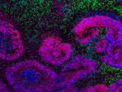 Alimlərdən ilk - Beyin atlası tərtib etdilər