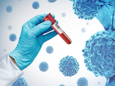 Bu xəstəliklərin diaqnostikası icbari tibbi sığortaya daxil edildi