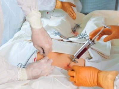 Sümük iliyinin transplantasiyasını həyata keçirən xəstəxanaların sayı ARTIRILDI