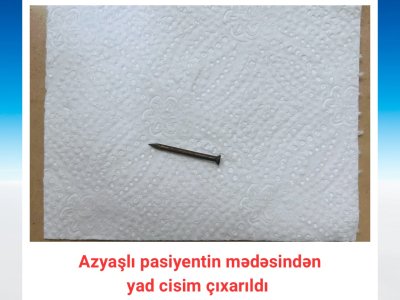 Bakıda azyaşlının mədəsindən mismar çıxarıldı - FOTO
