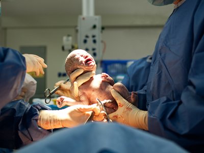 &ldquo;Qeysəriyyə əməliyyatlarının sayı 10 faizədək azalıb&rdquo;&nbsp;