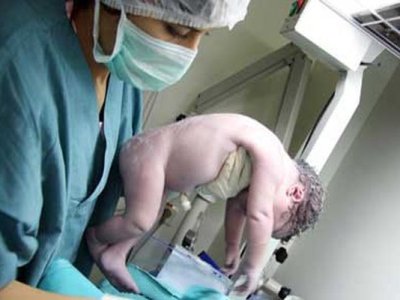 Qız uşağı doğuş zamanı öldü