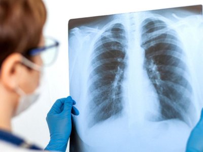 Məktəblilər arasında pnevmoniya sürətlə yayılır - XƏBƏRDARLIQ