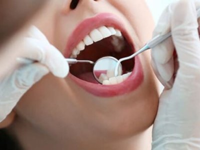 Azərbaycanda 74 stomatoloq qanunsuz fəaliyyət göstərirmiş