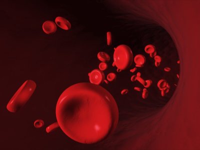 Azərbaycanda neçə talassemiya xəstəsi var? - RƏSMİ CAVAB