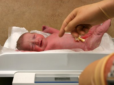 Azərbaycanda 1 445 azçəkili körpə doğulub