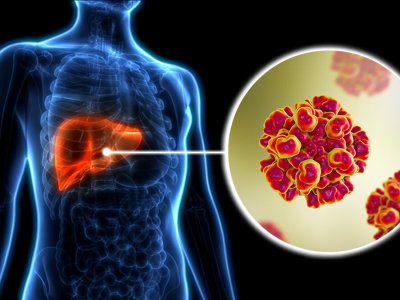 Bu ölkədə hepatit E virusuna yoluxma qeydə alındı