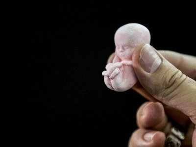 Azərbaycanda abortların sayı rekord həddə çatıb