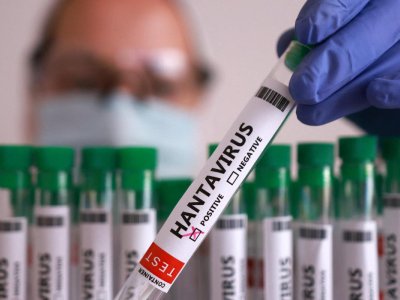 Daha bir nəfərdə hantavirus aşkarlandı