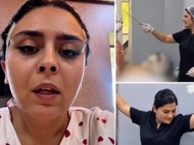 "Sinirlərimi kəsib"&nbsp;- əməliyyatda rəqs edən həkimdən yenə ŞİKAYƏT VAR