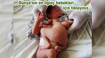 Bir neçə gün başsız yaşayan körpə...