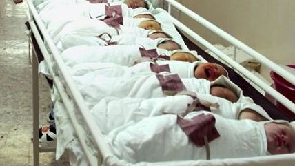 Azərbaycanda anormal doğulan körpələrin sayı artıb