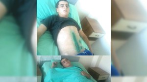 Heydər Əliyev adına Ali Hərbi Məktəbdə döyülən əsgərin dalağını çıxarıblar 