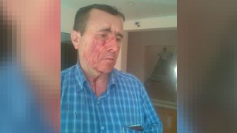 “Hürriyyət”in İmişlidə döyülən müxbirinin FOTOLARI yayımlanıb