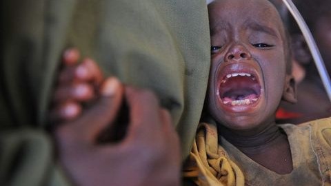 Somalidə inanılmaz aclıq görüntüləri (FOTOLAR)