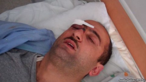 ARDNŞ İdrak Abbasovu döyənləri işdən qovacaq