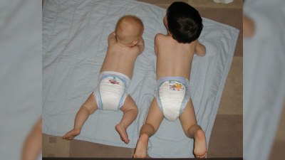Azərbaycan həkimləri həyəcan təbili çalırlar - "Pampers" allergiya mənbəyidir