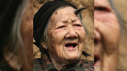 101 yaşlı nənə buynuz çıxartdı – FOTO