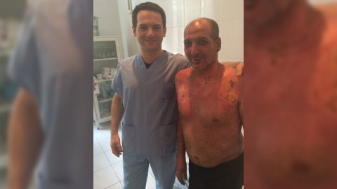 Özünü yandıran əlil: “İntihar edən 8 nəfərdən tək mən sağ qaldım” - FOTO