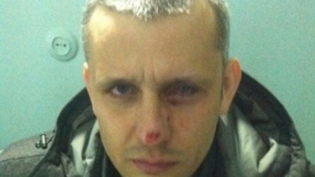 Kiyevdə jurnalist öldürüldü