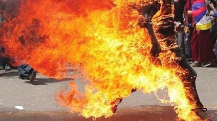 Bakıda özünü yandıran qadın öldü