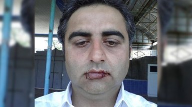 Azərbaycanda sahibkar milyarderə etiraz əlaməti olaraq ağzını tikib