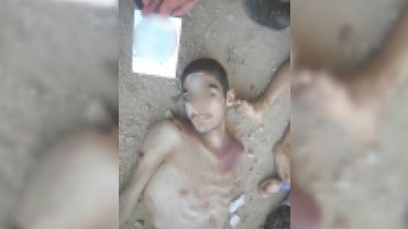 Suriyada dünyanı ayağa qaldıracaq yeni dəhşətli işgəncə FOTOLARI
