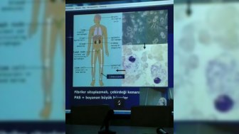 ATU-da Türkiyə tibb mərkəzləri ilə telekonfrans keçirilib - FOTO