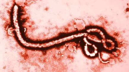 Yaponiya “Ebola” virusuna qarşı əlac tapıb