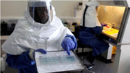Rusiyada “Ebola” əleyhinə peyvənd hazırlanıb 