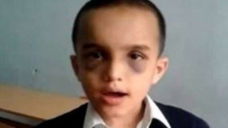 “40 uşaq ailəsinə qaytarılıb” – Qapanmış internat məktəbi ilə bağlı Təhsil Nazirliyindən AÇIQLAMA 
