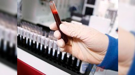 Azərbaycanda talassemiya xəstəliyinin ən çox yayıldığı RAYONLAR