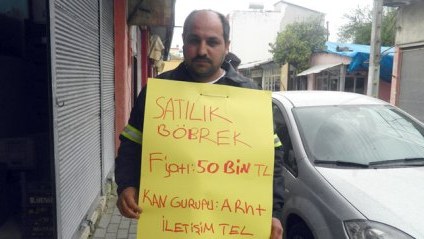Kredit borcunu ödəyə bilməyən böyrəyini satır
