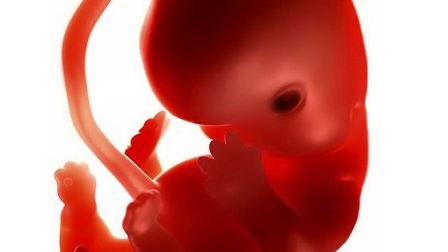 Abort Ermənistanın ən ciddi problemlərindən biridir