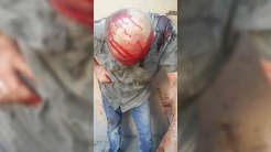 Ermənistanda müharibə veteranını amansızlıqla döydülər - FOTOLAR 