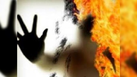Kredit borcuna görə özünü yandıran kişinin vəziyyəti çox ağırdır – HƏKİM  