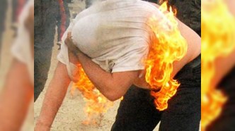 Bakıda borca görə özünü yandıran kişinin üzünə dəri köçürüləcək