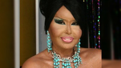 Bülent Ersoy “donuz qripi”nə yoluxub