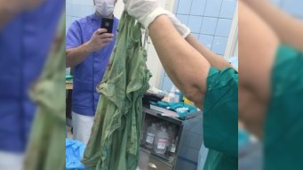 Doğuşu qəbul edən həkimdən səhv – Mələfəni unutdu