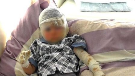 Yandırılan uşağa görə yeni həbslər gözlənilir