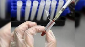 Azərbaycanda qanında QİÇS aşkarlanan daha 2 nəfər evlənməkdən imtina etdi