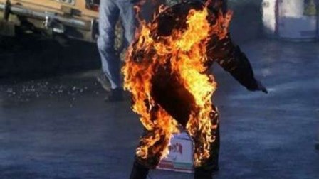 Sərxoş vəziyyətdə özünü yandırdı – Bakıda 