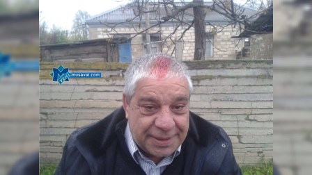   Cəbhə bölgəsinə yollanan QAT üzvü başından yaralanıb