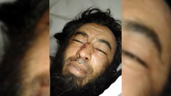 Suriyada daha bir azərbaycanlı öldürüldü – FOTO
