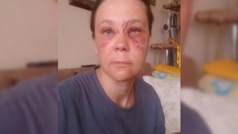 Eskalator qadını bu hala saldı, "Azəravtoyol&rdquo; səbəbini A&Ccedil;IQLADI - FOTO
