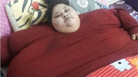 500 kiloqramlıq qadın Hindistana m&uuml;alicəyə gətirildi