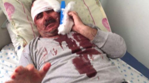 &ldquo;Reket&rdquo; baş redaktor d&ouml;y&uuml;ld&uuml; - FOTO