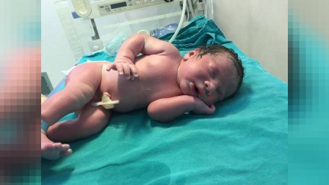 Azərbaycanda yenidoğulmuş appendisitdən əməliyyat olundu - FOTO