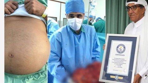 Azərbaycanlı böyrək xəstəsi “Ginnesin rekordlar kitabı”na namizəddir - Eksklüziv - FOTOLAR, VİDEO
